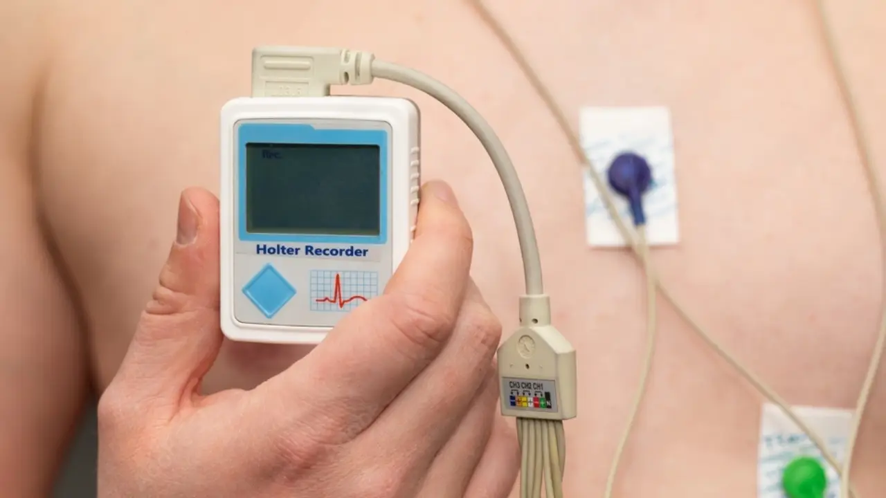 Holter ECG – (Holter rythmique) -Fes